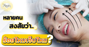 ร้อยไหมเจ็บไหม