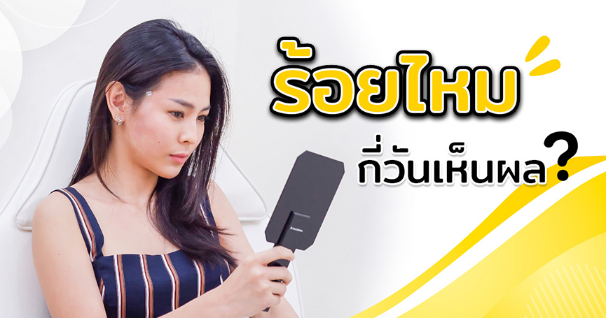 ร้อยไหมกี่วันเห็นผล