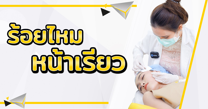 ร้อยไหมหน้าเรียว