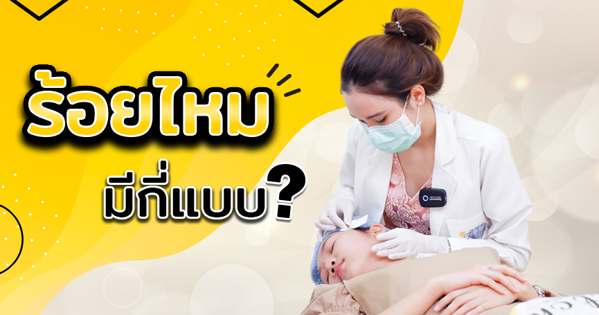 ร้อยไหมมีกี่แบบ