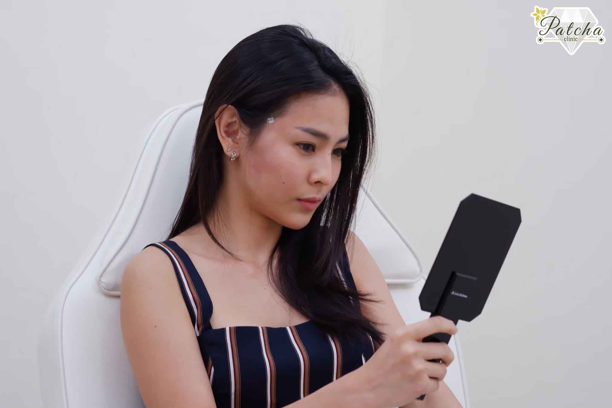 อาการบวม