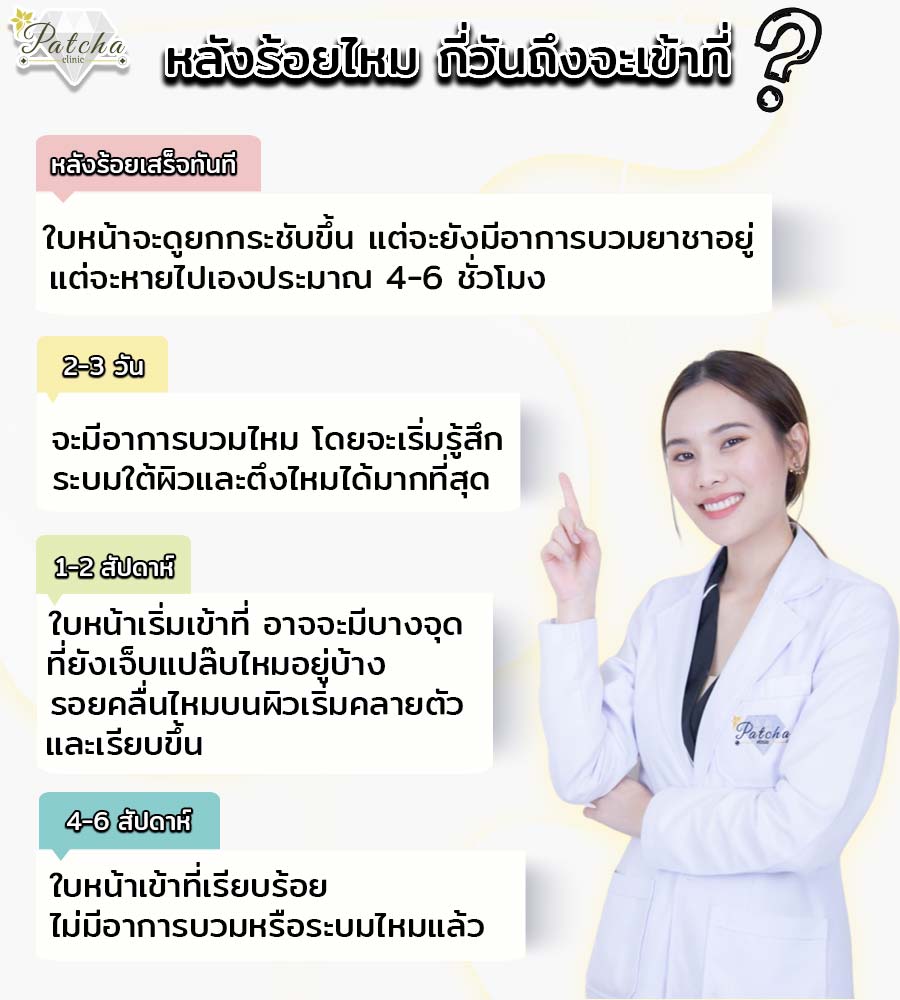 ร้อยไหมกี่วันถึงเข้าที่