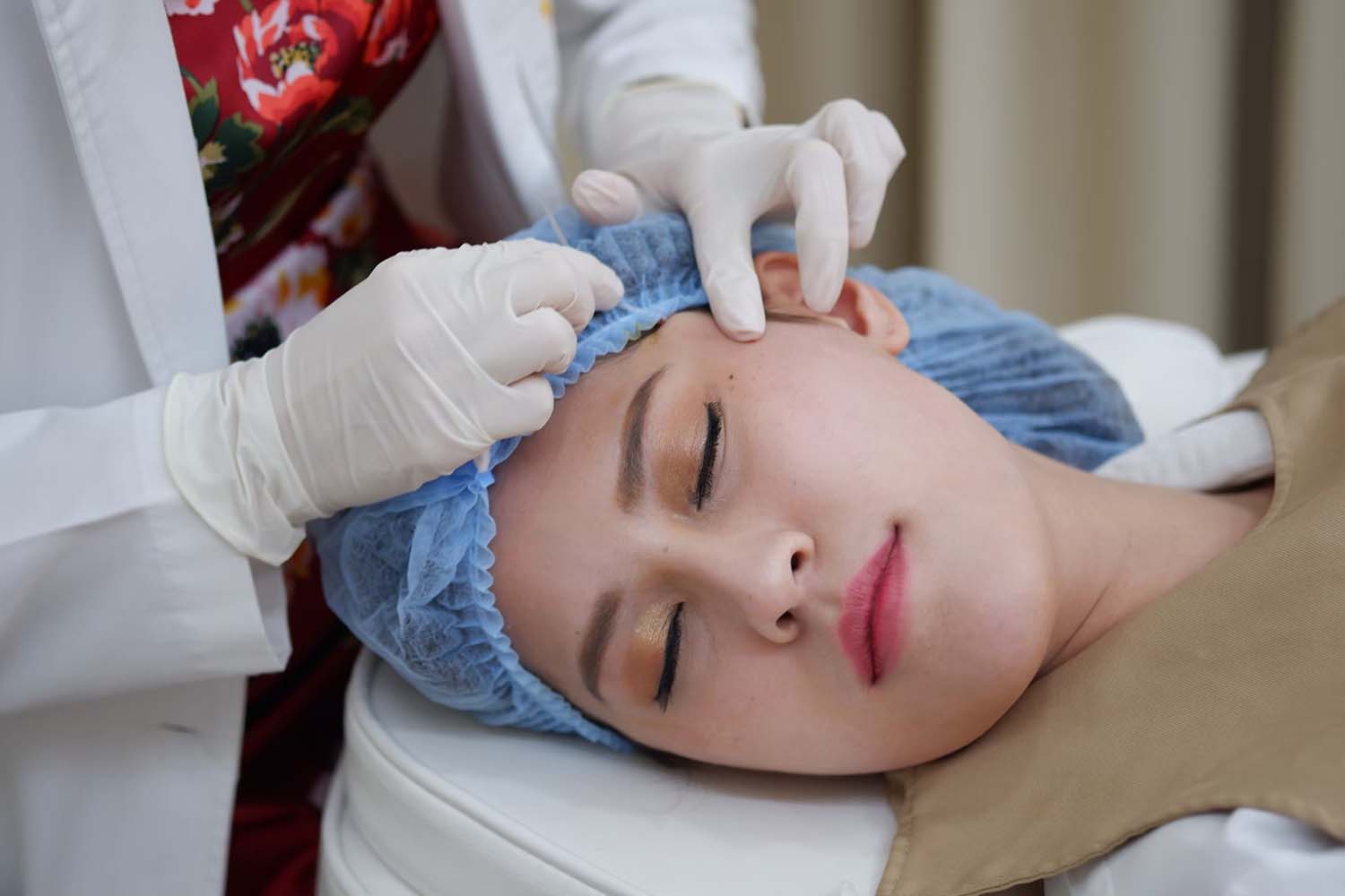 ผลลัพธ์การร้อยไหม