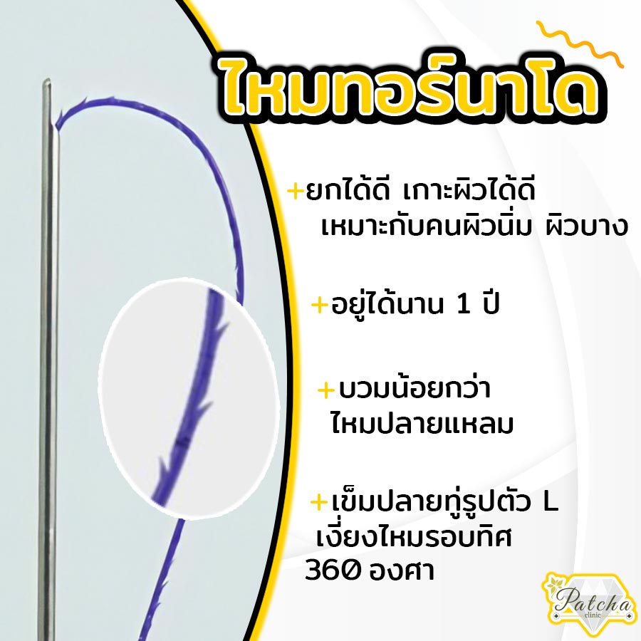 ลักษณะไหมทอร์นาโด
