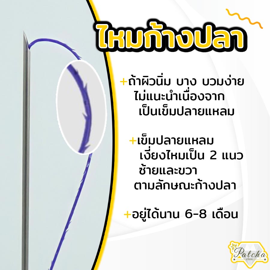 ลักษณะไหมก้างปลา