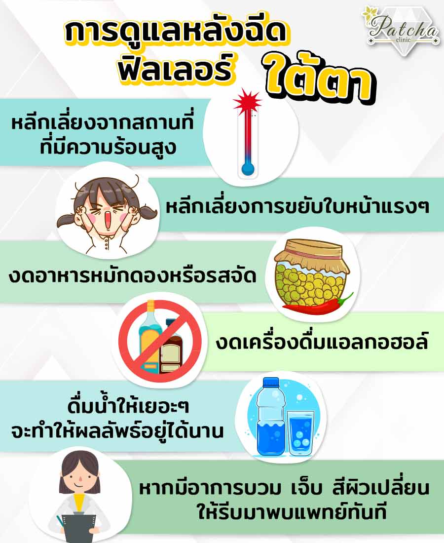 ดูแลหลังฉีดใต้ตา