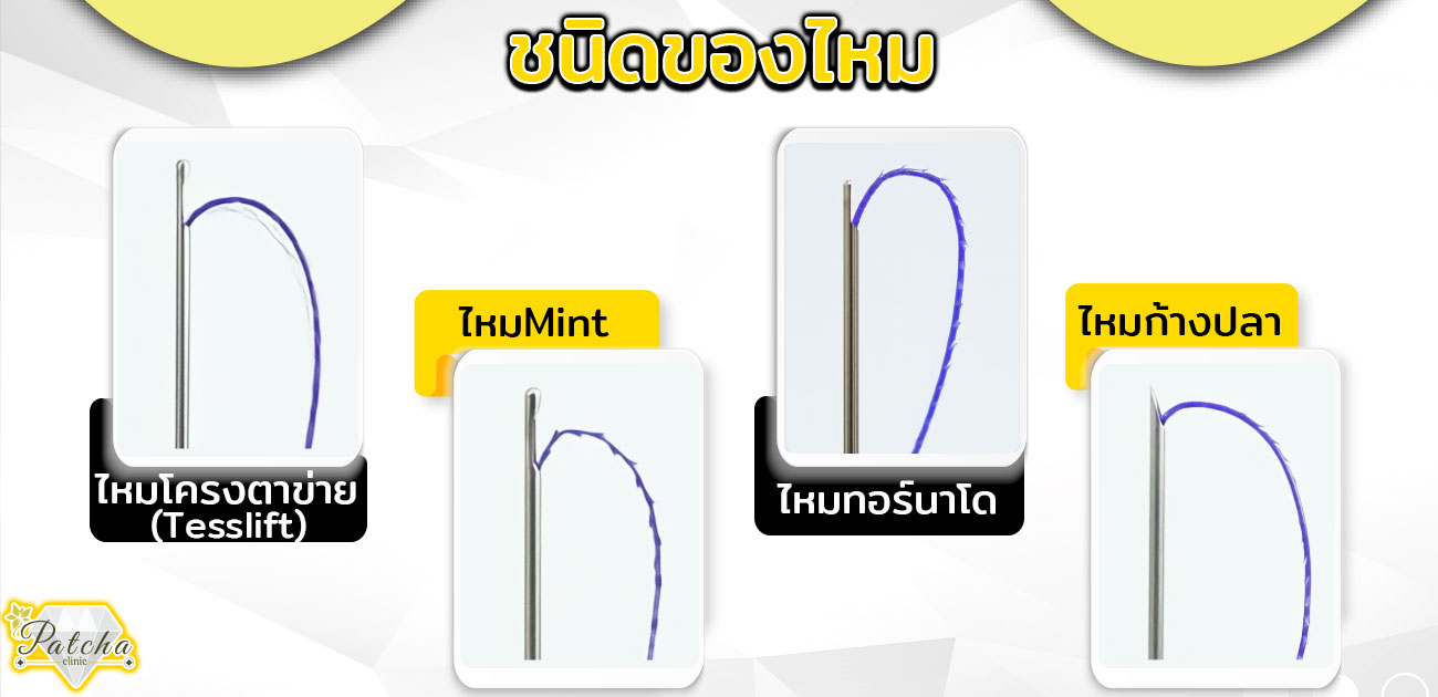 ชนิดของไหม