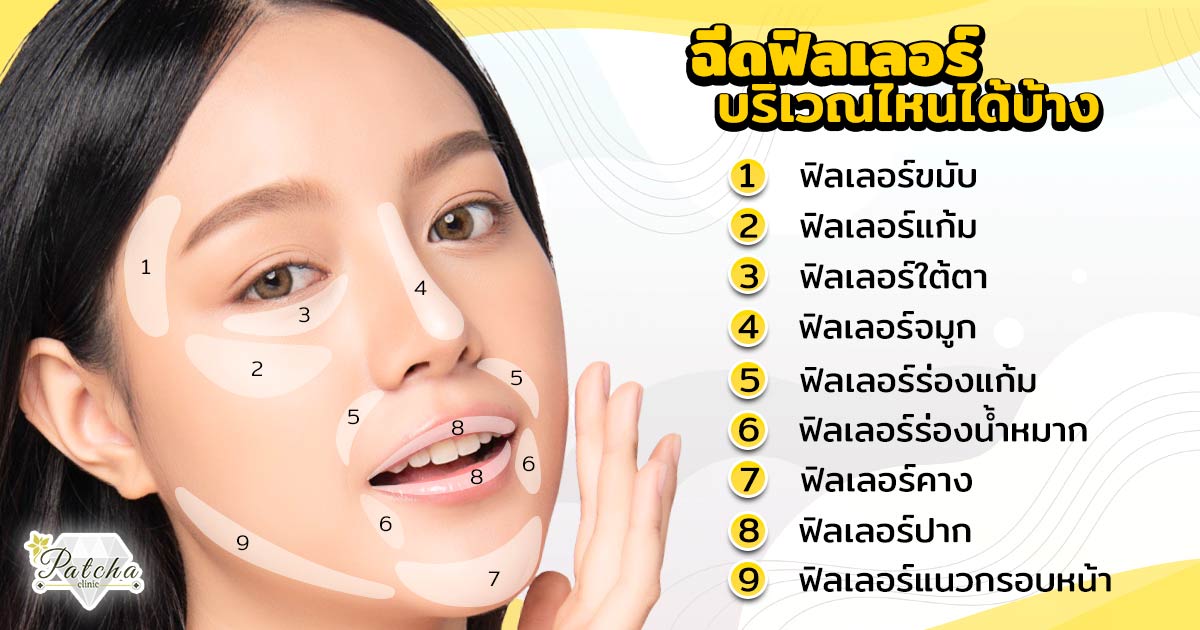 ฟิลเลอร์ฉีดตรงไหน